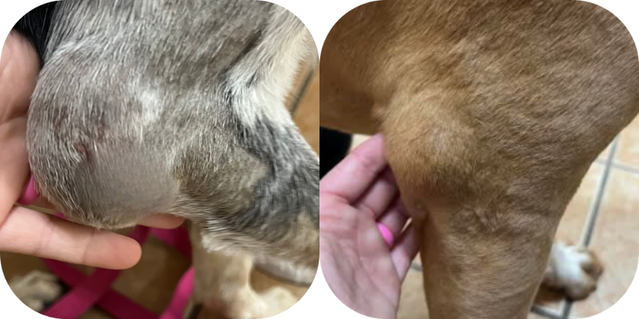 Hygroma